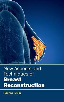 New Aspects and Techniques of Breast Reconstruction - cover