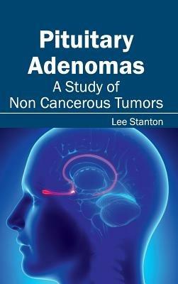 Pituitary Adenomas: A Study of Non Cancerous Tumors - cover