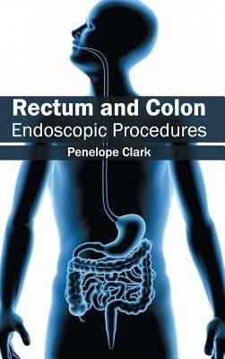 Rectum and Colon: Endoscopic Procedures - cover