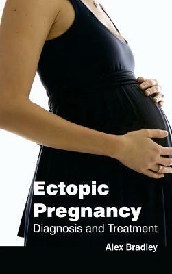 Ectopic Pregnancy: Diagnosis and Treatment - cover