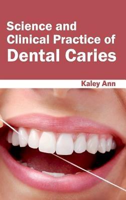 Science and Clinical Practice of Dental Caries - cover