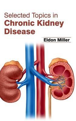Selected Topics in Chronic Kidney Disease - cover