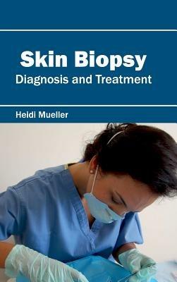 Skin Biopsy: Diagnosis and Treatment - cover