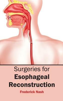 Surgeries for Esophageal Reconstruction - cover