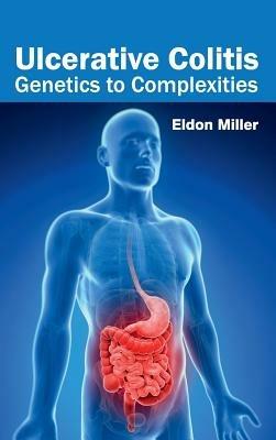 Ulcerative Colitis: Genetics to Complexities - cover
