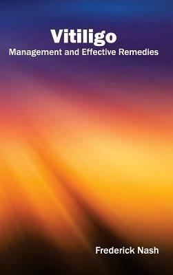 Vitiligo: Management and Effective Remedies - cover