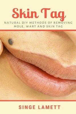 Skin Tag: Natural DIY Methods of removing Mole, Wart and Skin Tag - Singe Lamett - cover