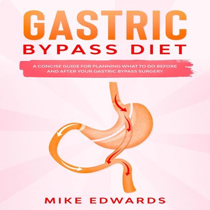 Gastric Bypass Diet: A Concise Guide for Planning What to Do Before and After your Gastric Bypass Surgery