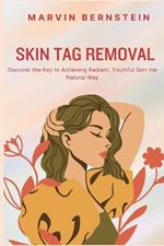 Skin Tag Removal: Discover the Key to Achieving Radiant, Youthful Skin the Natural Way
