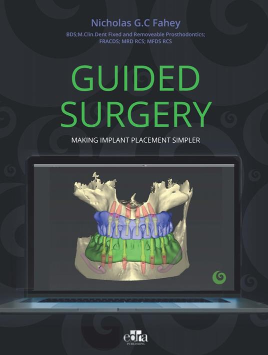 Guided surgery. Making implant placement simpler - Nicholas G.C. Fahey - copertina