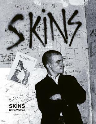Skins: Gavin Watson - Gavin Watson - cover