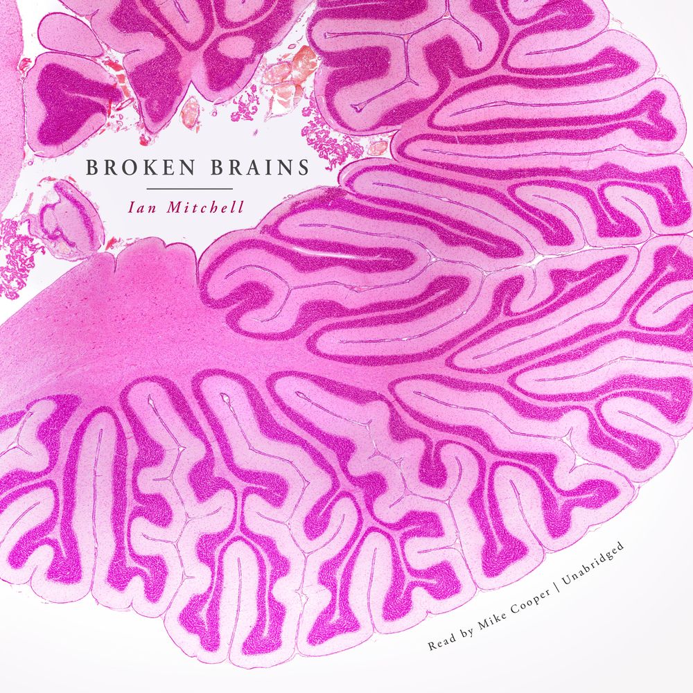 ibs
