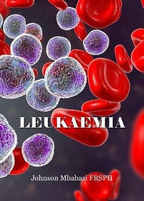 Leukaemia - Johnson Mbabazi - cover