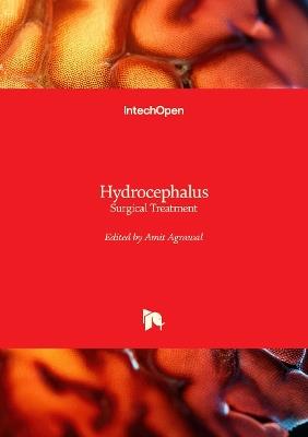 Hydrocephalus: Surgical Treatment - Amit Agrawal - cover
