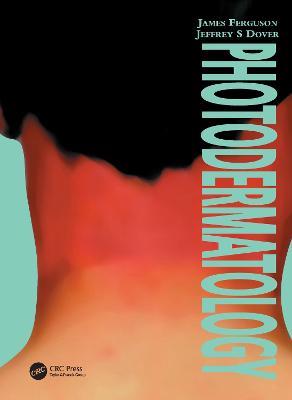 Photodermatology - James Ferguson,Jeffrey Dover - cover