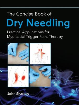The Concise Book of Dry Needling: Practical Applications for Myofascial Trigger Point Therapy - John Sharkey - cover