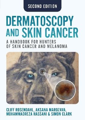Dermatoscopy and Skin Cancer, second edition: A handbook for hunters of skin cancer and melanoma - Cliff Rosendahl,Aksana Marozava,Mohammadreza Hassani - cover