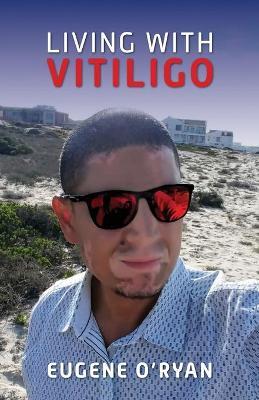 Living with Vitiligo - Eugene O'Ryan - cover