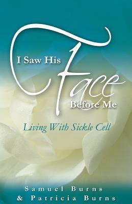 I Saw His Face Before Me - Living with Sickle Cell Anemia - Samuel a Burns,Patricia a Burns - cover