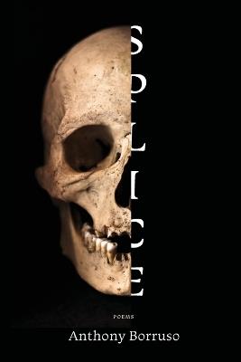 Splice - Anthony Borruso - cover