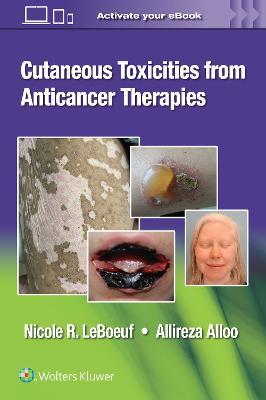 Cutaneous Toxicities from Anticancer Therapies - Nicole LeBoeuf,Allireza Alloo - cover