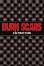 Burn Scars