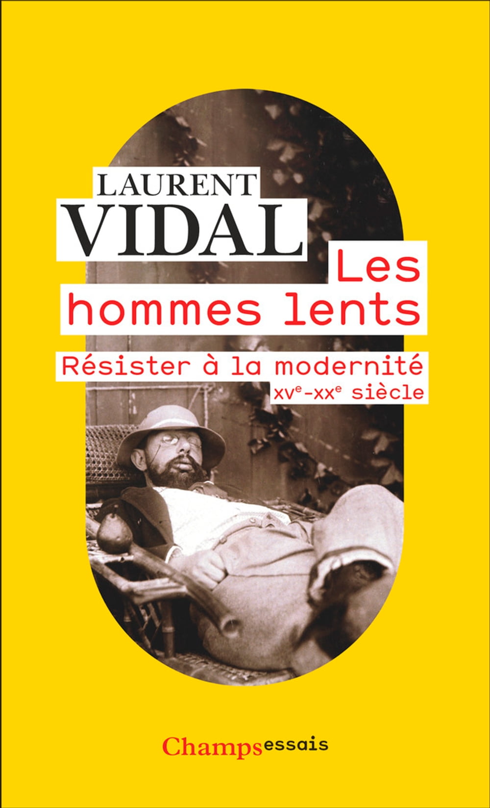 ibs