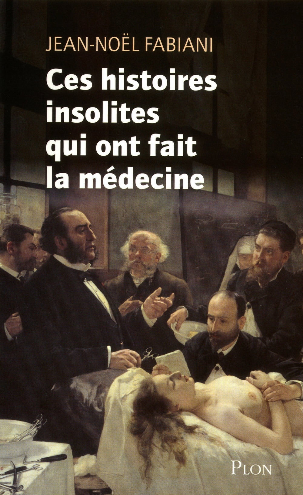 ibs