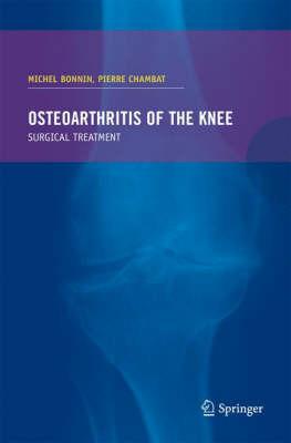 Osteoarthritis of the knee - cover