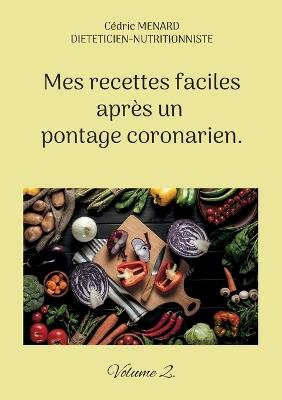 Mes recettes faciles après un pontage coronarien.: Volume 2. - Cédric Menard - cover
