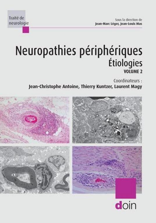 Neuropathies périphériques : étiologies