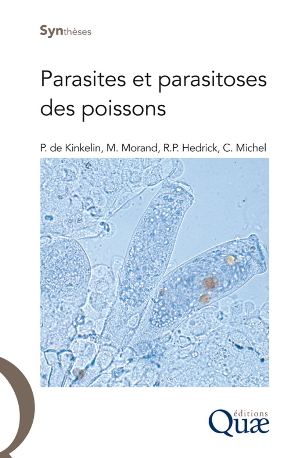 ibs
