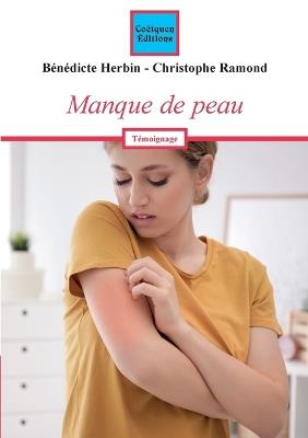 Manque de peau - Bénédicte Herbin,Christophe Ramond - cover