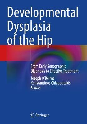 Developmental Dysplasia of the Hip: From Early Sonographic Diagnosis to Effective Treatment - cover