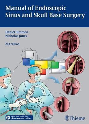 Manual of Endoscopic Sinus and Skull Base Surgery - cover