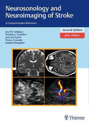 Neurosonology and Neuroimaging of Stroke: A Comprehensive Reference - Jose Manuel Valdueza,Stephan Schreiber,Jens-Eric Roehl - cover