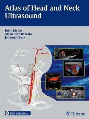 Atlas of Head and Neck Ultrasound - Heinrich Iro,Alessandro Bozzato,Johannes Zenk - cover