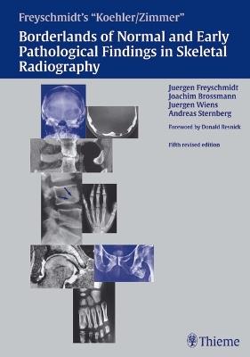 Freyschmidt's "Koehler/Zimmer" Borderlands of Normal and Early Pathological Findings in Skeletal Radiography - Jürgen Freyschmidt,Joachim Brossmann,Jürgen Wiens - cover