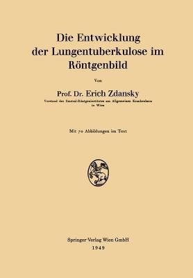 Die Entwicklung der Lungentuberkulose im Röntgenbild - Erich Zdansky - cover