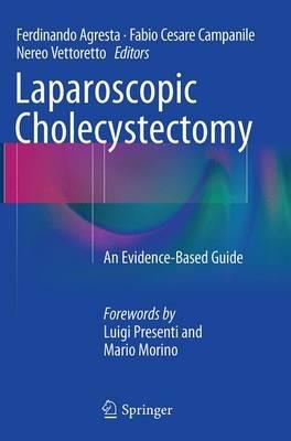 Laparoscopic Cholecystectomy: An Evidence-Based Guide - cover