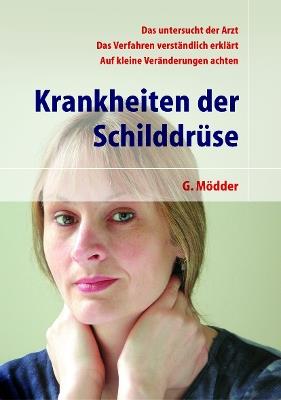 Krankheiten der Schilddrüse - Gynter Mödder - cover