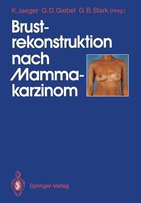 Brustrekonstruktion nach Mammakarzinom - cover