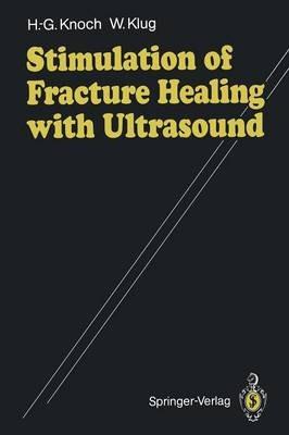 Stimulation of Fracture Healing with Ultrasound - Hans-Georg Knoch,Winfried Klug - cover