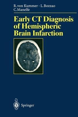 Early CT Diagnosis of Hemispheric Brain Infarction - Rüdiger v. Kummer,Luigi Bozzao,Claude Manelfe - cover