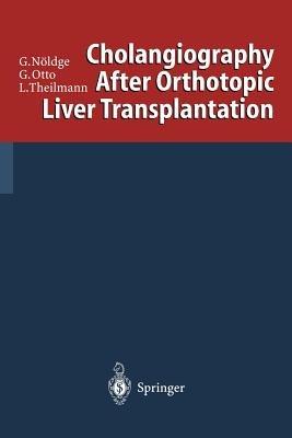 Cholangiography After Orthotopic Liver Transplantation - Gerd Nöldge,Gerd Otto,Lorenz Theilmann - cover