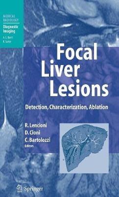 Focal Liver Lesions: Detection, Characterization, Ablation - cover