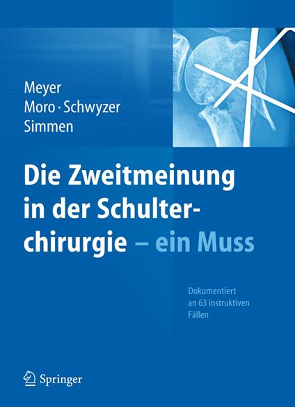 Die Zweitmeinung in der Schulterchirurgie - ein Muss