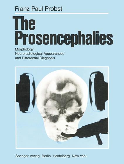 The Prosencephalies