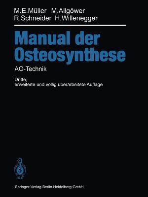 Manual der OSTEOSYNTHESE: AO-Technik - Maurice E. Müller,Martin Allgöwer,Robert Schneider - cover