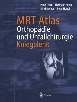 MRT-Atlas Orthopädie und Unfallchirurgie: Kniegelenk - Peter Teller,Hermann König,Ulrich Weber - cover